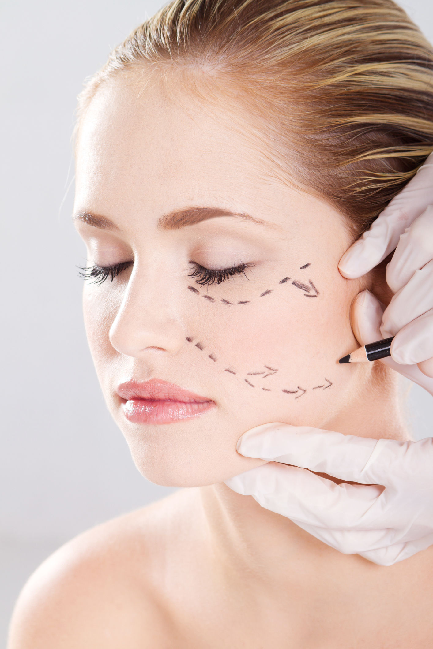 Botox Facial Sculpting Program