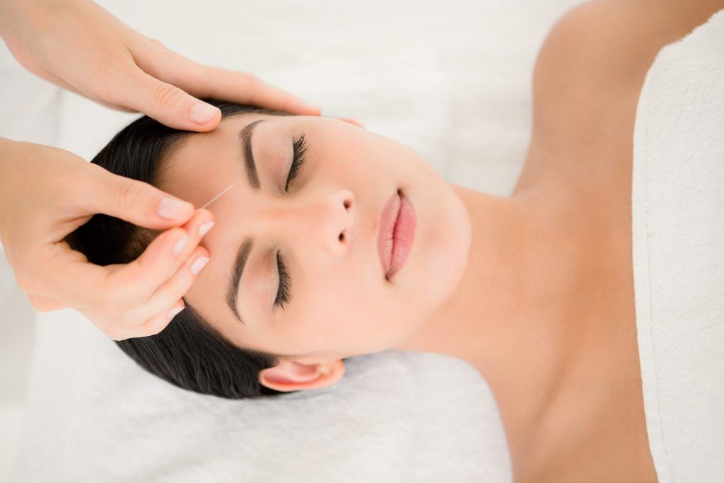 We tried facial acupuncture to combat puffiness, and here’s what happened