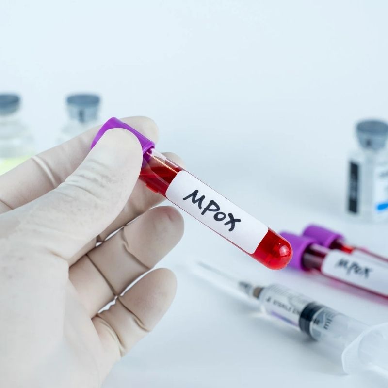 Cacar monyet atau MPOX diisytihar sebagai darurat kesihatan awam oleh WHO, ini semua tentangnya