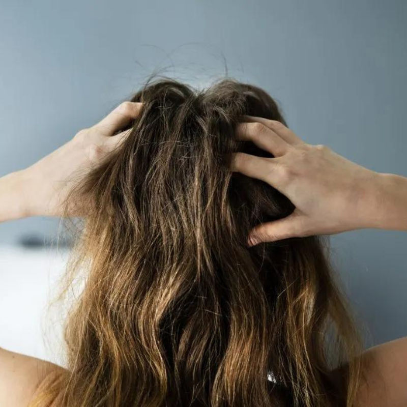 The causes of hair loss at the crown — plus, what to do about it, according to experts