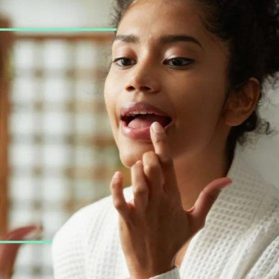 Dry lips causes and treatments, according to a doctor Idiom Studio