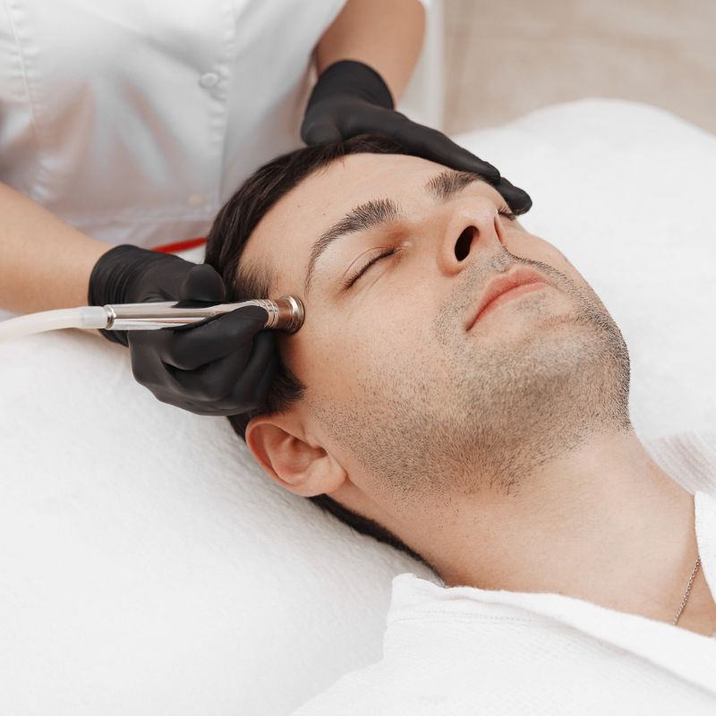 What is microdermabrasion? Here’s everything to know about it