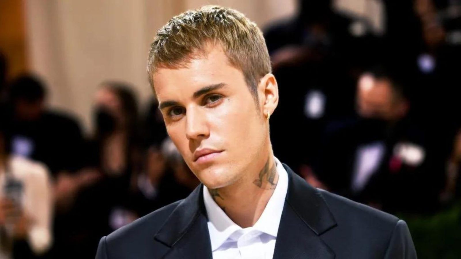 How do you get Ramsay Hunt syndrome? Justin Bieber’s condition, explained