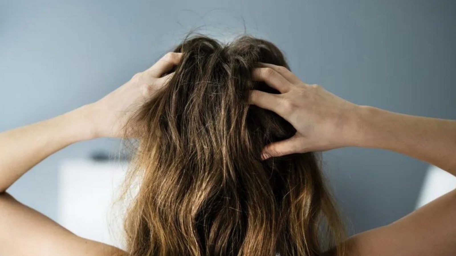 The causes of hair loss at the crown and how to prevent it, according to experts