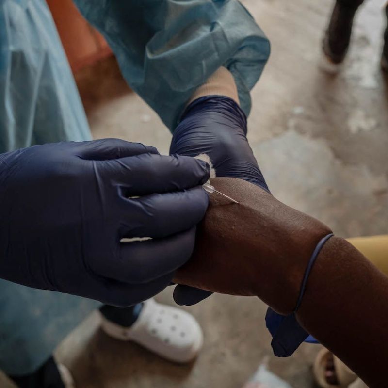 All we know about the mpox outbreak, and how Malaysia is preparing for it