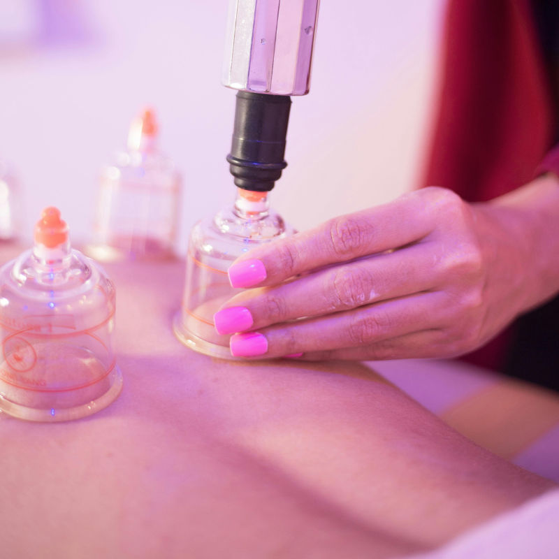 Cupping therapy: How it works, its benefits and potential risks