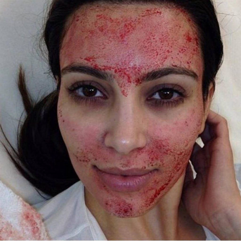 Bee venom to bird poop treatments: 7 of the most bizarre facials in the world