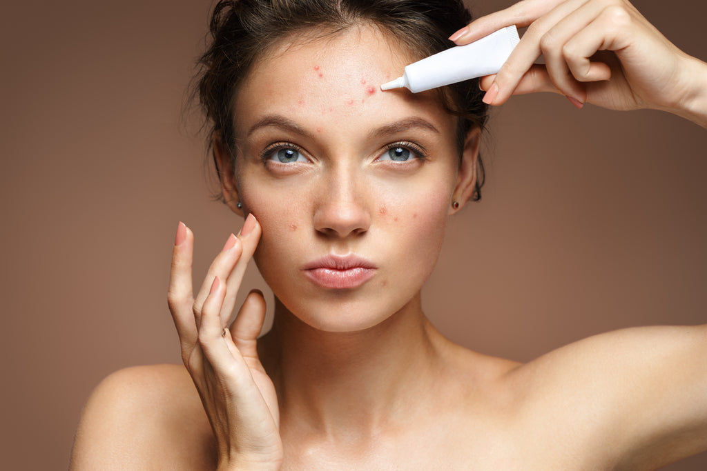 Tea tree oil is the holy grail of acne-free skin (plus, check out the best buys)