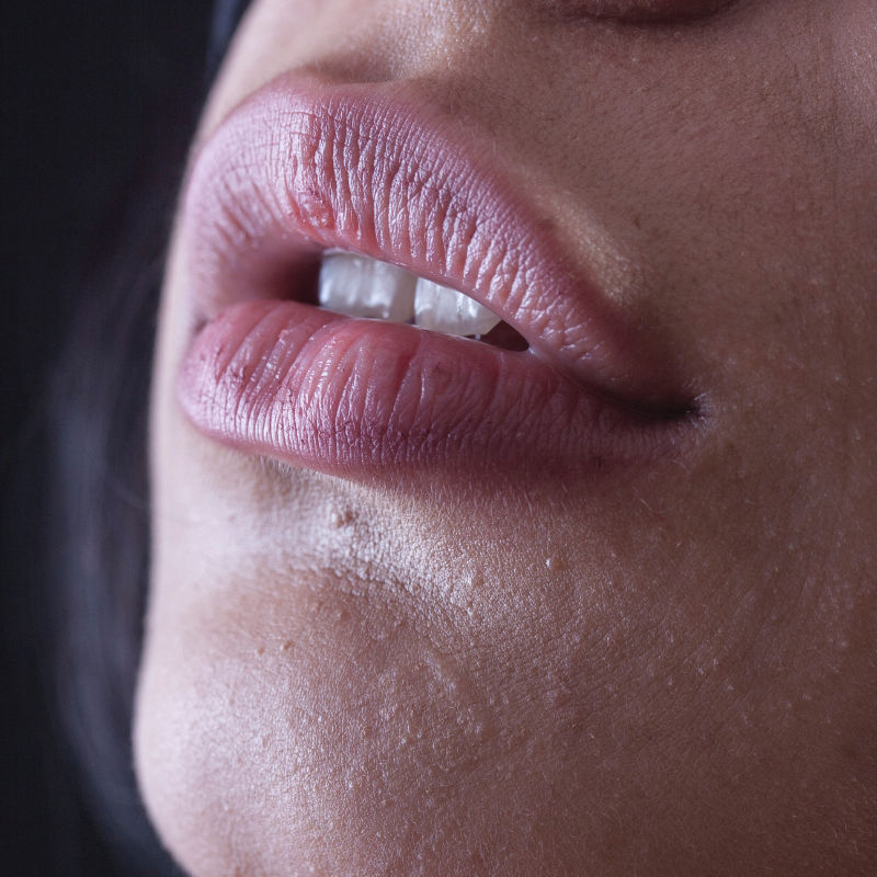 Lip pigmentation