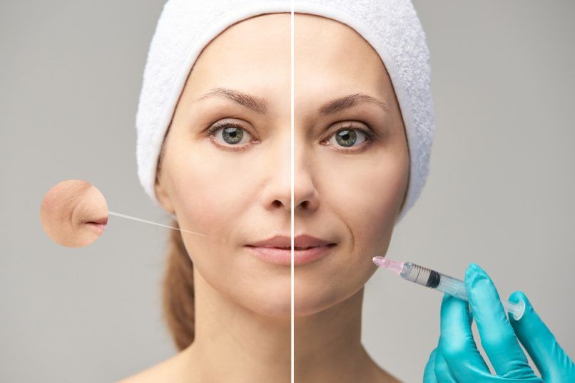 glutathione and grey hair Details on glutathione injections after the Made in Heaven controversy