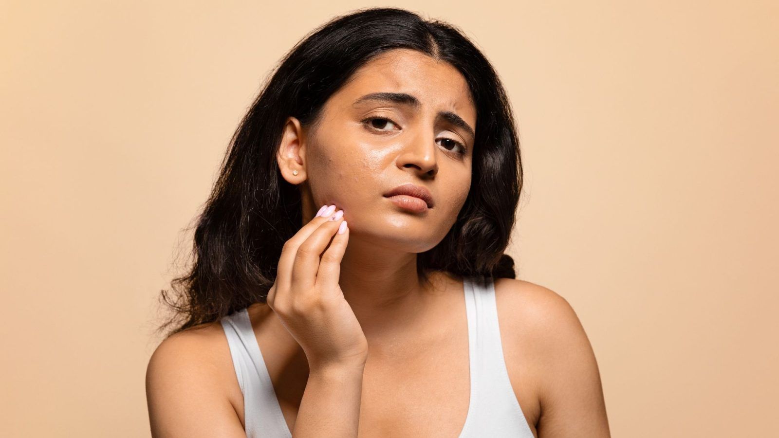 Top acne creams for oily skin that actually work