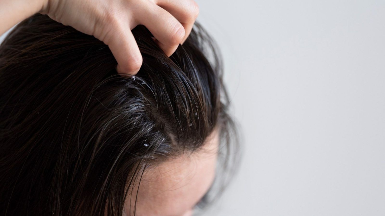 Does hot water bath cause dandruff? Expert tells us the disadvantages